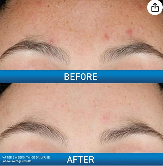 cerave resurfacing retnole serum